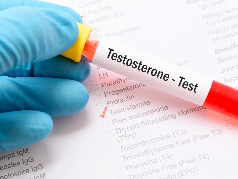Exame de Testosterona: como interpretar os resultados?