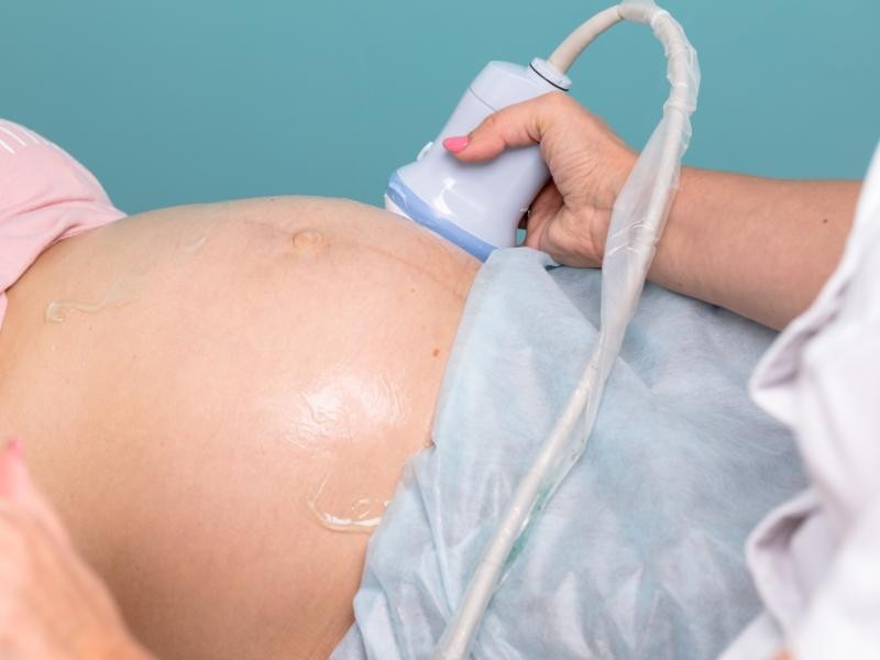 Ultrassom obstétrico: Como funciona e qual o preparo necessário?
