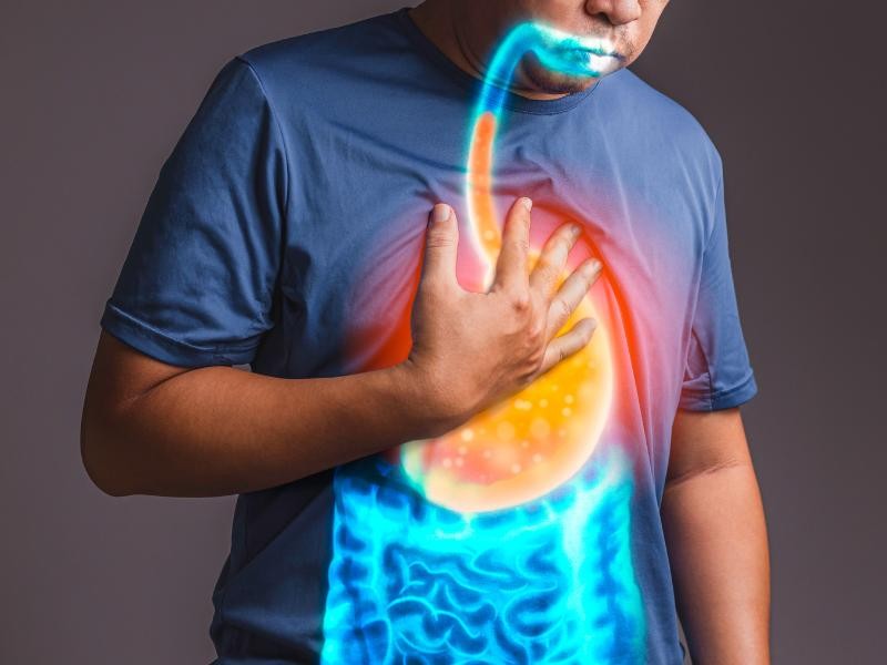 O Gastroenterologista Pode Tratar Problemas Digestivos Como Refluxo?